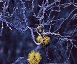 St. Jude researchers reveal structure of Parkinson's-linked proteins