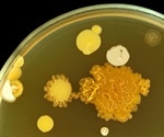 Protective bacterial communities consume the nutrients to starve out pathogens