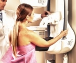 AI-based risk model for breast cancer screening