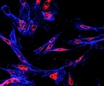 Protein "on/off switch" controls breast cancer spread and immunotherapy response