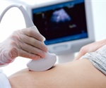 New ultrasound technology shows promise for preventing brain damage in premature and sick infants